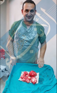 %d8%b9%d9%85%d9%84%d9%8a%d8%a9-%d8%a8%d8%a3%d8%b3%d9%8a%d9%88%d8%b7-%d9%84%d9%88%d8%ac%d9%88