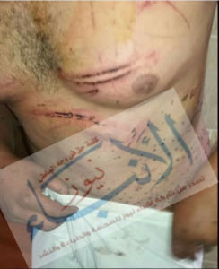 %d8%a8%d9%84%d8%b7%d8%ac%d9%8a%d8%a9-%d9%8a%d8%b9%d8%aa%d8%af%d9%88%d9%86-%d8%b9%d9%84%d9%89-%d8%ad%d9%84%d8%a7%d9%82-%d9%84%d9%88%d8%ac%d9%88